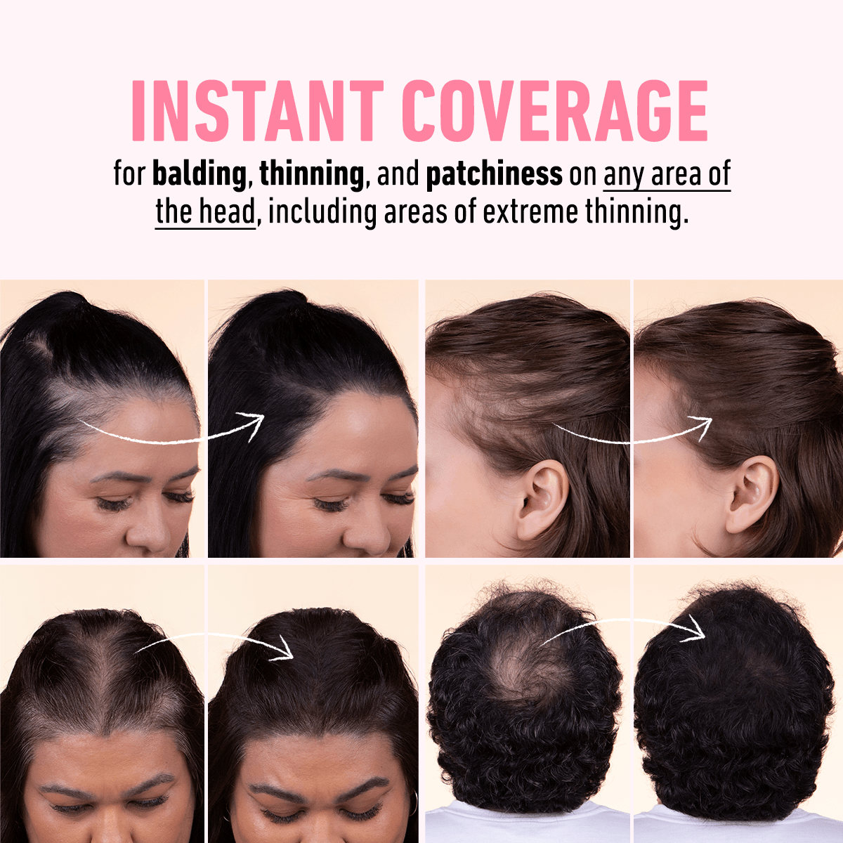 Hairline Powder Starter Kit - Your All-In-One Kit for Flawless Roots, a Fuller Hairline, and Instant Confidence