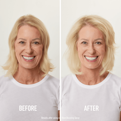 Root Boosting Spray